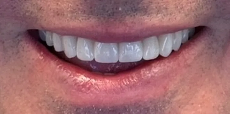 patient 1 after