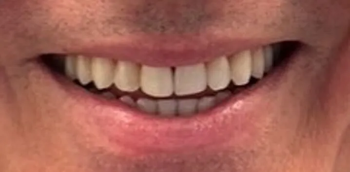 patient 1 before